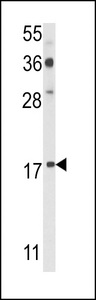 Western blot of PDRG Antibody in A2058 cell line lysates (35 ug/lane). PDRG (arrow) was detected using the purified antibody.
