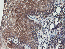 IHC of paraffin-embedded Human tonsil using anti-PDRG1 mouse monoclonal antibody. (Heat-induced epitope retrieval by 10mM citric buffer, pH6.0, 100C for 10min).