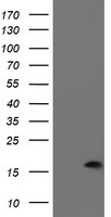 HEK293T cells were transfected with the pCMV6-ENTRY control (Left lane) or pCMV6-ENTRY PDRG1 (Right lane) cDNA for 48 hrs and lysed. Equivalent amounts of cell lysates (5 ug per lane) were separated by SDS-PAGE and immunoblotted with anti-PDRG1.