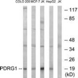 Western blot of extracts from Jurkat/COLO/MCF-7/HepG2 cells, using PDRG1 Antibody. The lane on the right is treated with the synthesized peptide.