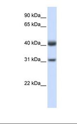 Fetal muscle lysate. Antibody concentration: 1.0 ug/ml. Gel concentration: 12%.