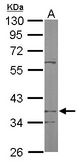 Sample (50 ug of whole cell lysate). A: Mouse brain. 10% SDS PAGE. PDSS2 / DLP1 antibody diluted at 1:1000.
