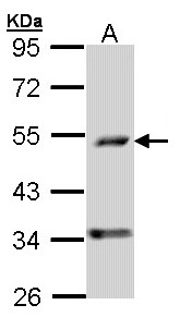Sample (30 ug of whole cell lysate). A: A431 . 10% SDS PAGE. PDSS2 / DLP1 antibody diluted at 1:1000.