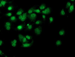 Anti-PDSS2 mouse monoclonal antibody immunofluorescent staining of COS7 cells transiently transfected by pCMV6-ENTRY PDSS2.