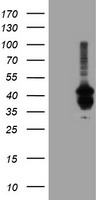 HEK293T cells were transfected with the pCMV6-ENTRY control (Left lane) or pCMV6-ENTRY PDSS2 (Right lane) cDNA for 48 hrs and lysed. Equivalent amounts of cell lysates (5 ug per lane) were separated by SDS-PAGE and immunoblotted with anti-PDSS2.