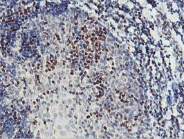 IHC of paraffin-embedded Human lymph node tissue using anti-PDSS2 mouse monoclonal antibody.