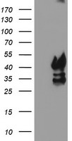 HEK293T cells were transfected with the pCMV6-ENTRY control (Left lane) or pCMV6-ENTRY PDSS2 (Right lane) cDNA for 48 hrs and lysed. Equivalent amounts of cell lysates (5 ug per lane) were separated by SDS-PAGE and immunoblotted with anti-PDSS2.