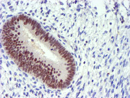 IHC of paraffin-embedded Human endometrium tissue using anti-PDSS2 mouse monoclonal antibody.