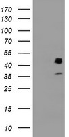 HEK293T cells were transfected with the pCMV6-ENTRY control (Left lane) or pCMV6-ENTRY PDSS2 (Right lane) cDNA for 48 hrs and lysed. Equivalent amounts of cell lysates (5 ug per lane) were separated by SDS-PAGE and immunoblotted with anti-PDSS2.