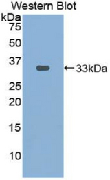Western blot of recombinant PDXK / PNK.