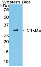 Western blot of recombinant PDXK / PNK.