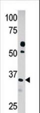 Western blot of anti-PDXK in HepG2 cell line lysate (35 ug/lane). PDXK(arrow) was detected using the purified antibody.
