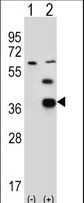 Western blot of PDXK (arrow) using rabbit polyclonal PDXK Antibody (H13). 293 cell lysates (2 ug/lane) either nontransfected (Lane 1) or transiently transfected (Lane 2) with the PDXK gene.