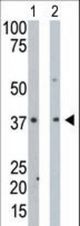 The anti-PDXK antibody is used in Western blot to detect PDXK in mouse intestine tissue lysate (Lane 1) and HeLa cell lysate (Lane 2).