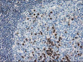 IHC of paraffin-embedded Human lymph node tissue using anti-PDXK mouse monoclonal antibody.