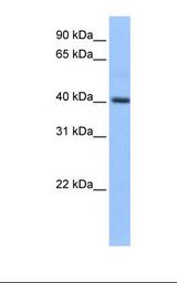 Fetal liver cell lysate. Antibody concentration: 1.0 ug/ml. Gel concentration: 12%.