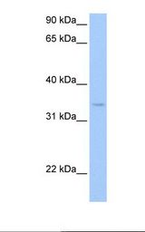 HepG2 cell lysate. Antibody concentration: 1.0 ug/ml. Gel concentration: 12%.