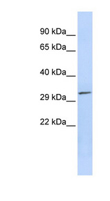 PDXP antibody LS-C102724 Western blot of Jurkat lysate.