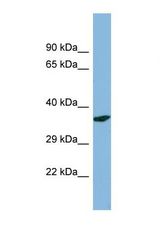 Western blot of Human HT1080 . PDXP antibody dilution 1.0 ug/ml.