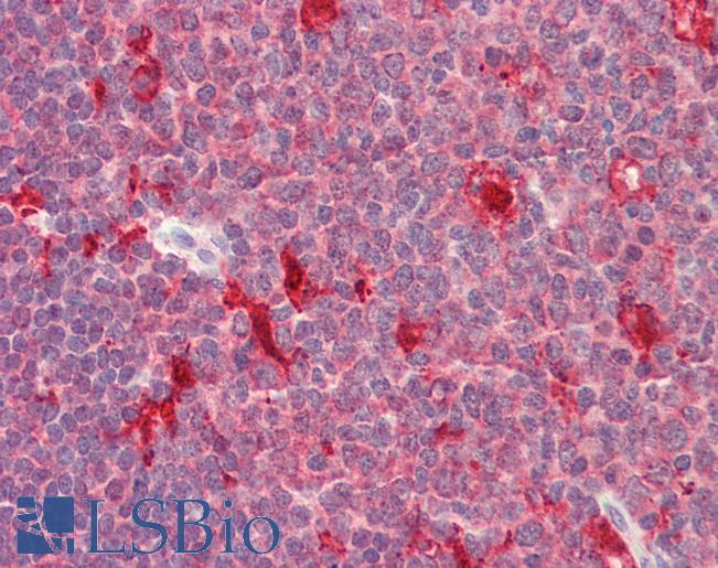 Human, Tonsil: Foramlin-Fixed Paraffin-Embedded (FFPE)