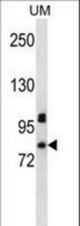 PDZD4 Antibody western blot of uterine tumor cell line lysates (35 ug/lane). The PDZD4 antibody detected the PDZD4 protein (arrow).