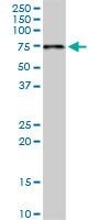 PDZK1 monoclonal antibody LS-b6114. Western blot of PDZK1 expression in human kidney.