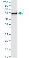 PDZK1 monoclonal antibody LS-B6115. Western blot of PDZK1 expression in human kidney.