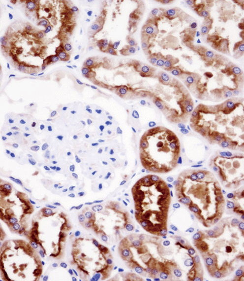 PDZK1 Antibody immunohistochemistry of formalin-fixed and paraffin-embedded human kidney tissue followed by peroxidase-conjugated secondary antibody and DAB staining.