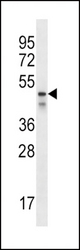 PDZK1 Antibody western blot of NCI-H292 cell line lysates (35 ug/lane). The PDZK1 antibody detected the PDZK1 protein (arrow).
