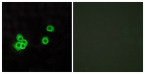 Immunofluorescence of MCF7 cells, using PEA15 Antibody. The picture on the right is treated with the synthesized peptide.