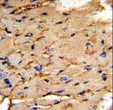 Formalin-fixed and paraffin-embedded mouse heart tissue reacted with PEA-15 Antibody , which was peroxidase-conjugated to the secondary antibody, followed by DAB staining. This data demonstrates the use of this antibody for immunohistochemistry; clinical relevance has not been evaluated.