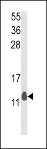 Western blot of PEA-15 Antibody in mouse lung tissue lysates (35 ug/lane). PEA-15 (arrow) was detected using the purified antibody.
