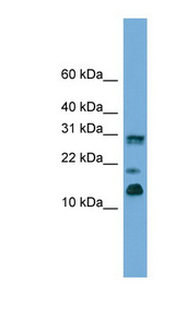 PEA15 antibody Western blot of Fetal Brain lysate.