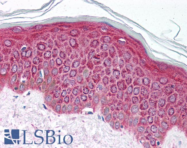 Anti-ETV4 / PEA3 antibody IHC of human skin. Immunohistochemistry of formalin-fixed, paraffin-embedded tissue after heat-induced antigen retrieval. Antibody LS-B1527 concentration 5 ug/ml.