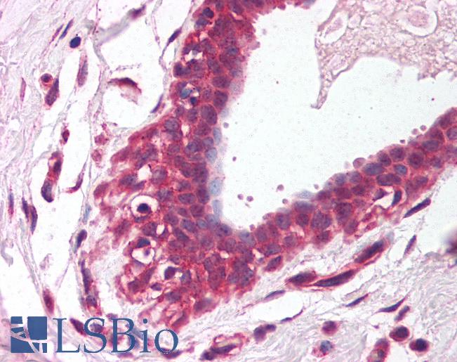 Anti-ETV4 / PEA3 antibody IHC of human breast. Immunohistochemistry of formalin-fixed, paraffin-embedded tissue after heat-induced antigen retrieval. Antibody LS-B1527 concentration 5 ug/ml.