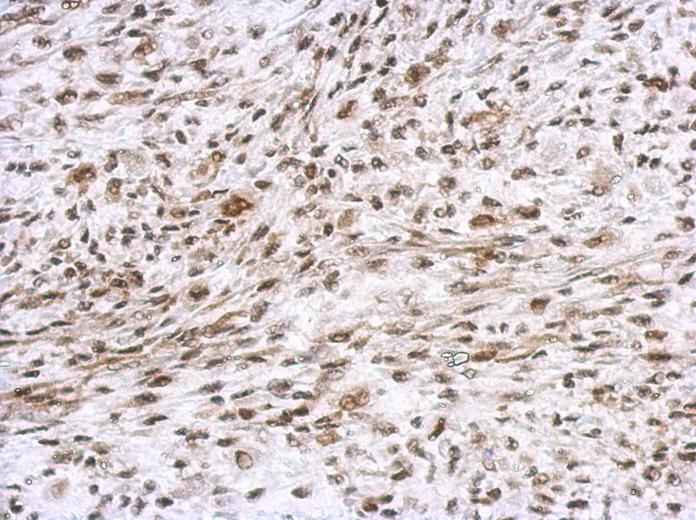IHC of paraffin-embedded C2C12 xenograft, using PEA3 antibody at 1:500 dilution.