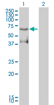 Western Blot analysis of ETV4 expression in transfected 293T cell line by ETV4 monoclonal antibody (M01), clone 3G9-1B9.Lane 1: ETV4 transfected lysate(54 KDa).Lane 2: Non-transfected lysate.