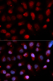Immunofluorescence analysis of U20S cell using ETV4 antibody. Blue: DAPI for nuclear staining.