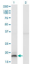 Western Blot analysis of IFNA13 expression in transfected 293T cell line by IFNA13 monoclonal antibody (M03), clone 3F9.Lane 1: IFNA13 transfected lysate(21.7 KDa).Lane 2: Non-transfected lysate.
