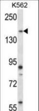 Mouse Sgk269 Antibody western blot of K562 cell line lysates (35 ug/lane). The Sgk269 antibody detected the Sgk269 protein (arrow).