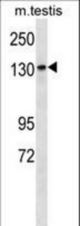 Mouse Sgk269 Antibody western blot of mouse testis tissue lysates (35 ug/lane). The Sgk269 antibody detected the Sgk269 protein (arrow).