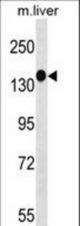 SGK269 Antibody western blot of mouse liver tissue lysates (35 ug/lane). The SGK269 antibody detected the SGK269 protein (arrow).