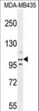 PEAR1 Antibody western blot of MDA-MB435 cell line lysates (35 ug/lane). The PEAR1 antibody detected the PEAR1 protein (arrow).