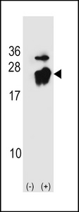 Western blot of PBP (arrow) using rabbit polyclonal PBP Antibody (A152). 293 cell lysates (2 ug/lane) either nontransfected (Lane 1) or transiently transfected (Lane 2) with the PBP gene.