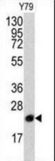 Western blot of anti-PBP antibody (RB03718) in Y79 cell line lysates (35 ug/lane). PBP(arrow) was detected using the purified antibody.