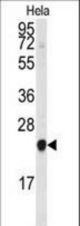 The anti-PBP antibody is used in Western blot to detect PBP in HeLa cell lysate.