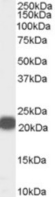 Antibody (0.01 ug/ml) staining of Human Prostate lysate (35 ug protein in RIPA buffer). Primary incubation was 1 hour. Detected by chemiluminescence.
