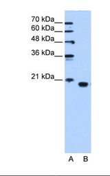 Lane A: Marker. Lane B: HepG2 cell lysate. Antibody concentration: 1.25 ug/ml. Gel concentration: 15%.