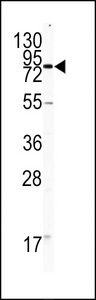 Western blot of CD31 antibody in HL60 cell line lysates (35 ug/lane). CD31 (arrow) was detected using the purified antibody.