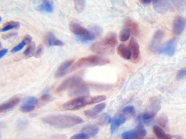 IHC of MIA antibody LS-C104285